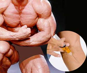 How To Make Your Product Stand Out With anti inflammatory steroids in 2021