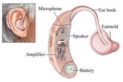 hearing_aids_work